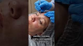 ВИДЕО-ОБУЧЕНИЕ. Комбинированная чистка лица 