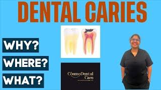 The Surprising Truth About Cavities