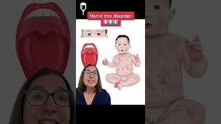 Name this disorder! #30: Pediatrics SHORT | @LevelUpRN