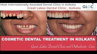 Cosmetic Dentistry in Kolkata | Best Cosmetic Dentist in Kolkata | Cosmetic Dental Clinic in Kolkata