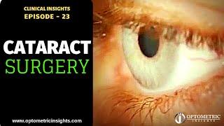 Dry Eye Before Cataract Surgery - Episode 23