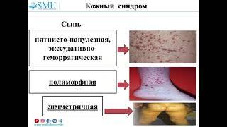 Геморрагический васкулит