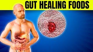 6 Best Prebiotic Foods for Ultimate Gut Health Balance