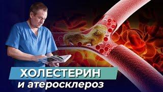 Холестерин и атеросклероз. Почему возникают холестериновые бляшки!