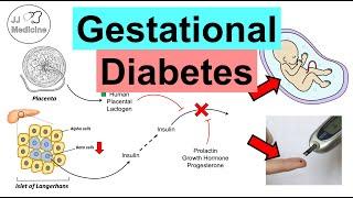 Gestational Diabetes (Pregnancy Diabetes) | Causes, Risk Factors, Symptoms, Consequences, Treatment