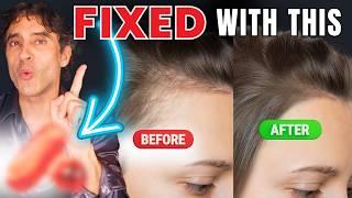 Shocking Truth About Hair Loss (You Don't Want To Miss)