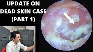 UPDATE On Rapid Skin Shedding Case (Part 1)