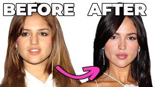 Eiza Gonzalez's FULL FACE Transformation: Plastic Surgery Secrets Revealed