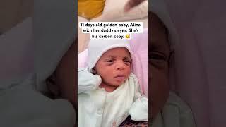 11 days old golden baby, Alina, with her daddy’s eyes.  She’s his carbon copy.