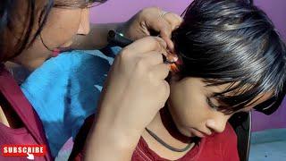 CUTE Little Girl Ear Cleaning and Ear Wax Removal | ear cleaning asmr#asmr