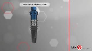 3D Animation - Pterigo Implant BTK SRL - 2015