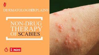 Kill scabies mites at home without using drugs: Scabies home treatment | Scabies prevention at home