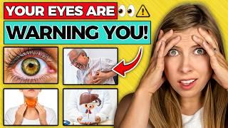 8 Ways Your Eye Warn You About Serious Health Conditions