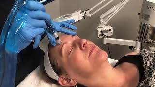 Benefits of Microneedling with PRP at Flowers Medical Group
