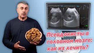 Псевдокисты в головном мозге: как их лечить? - Доктор Комаровский