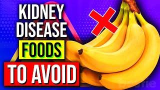STAY AWAY From These 17 Foods You Have KIDNEY Disease! ️
