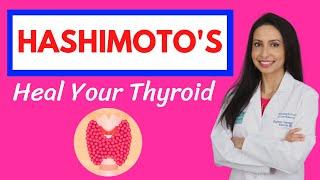 A Doctor's Guide to Hashimoto's:  Learn How to Heal Your Thyroid!