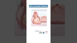  Microvascular disease: the hidden heart risk in women 