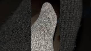 DEW attack on my foot