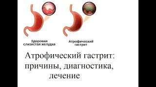 Атрофический гастрит: причины, диагностика, лечение