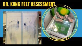 Dr. Kong feet assessment documentation #ObetTV