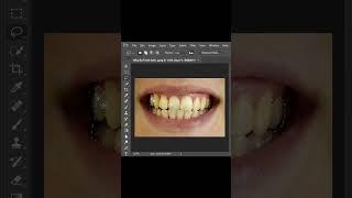 Yellow Teeth? Not Anymore! Photoshop Whitening Tutorial