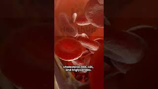 What Is a Lipid Profile Test? | Understanding Your Cholesterol Levels #j2healthup #support #facts