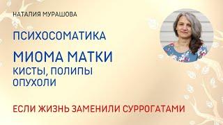 Миома матки, кисты, полипы. Психосоматика.