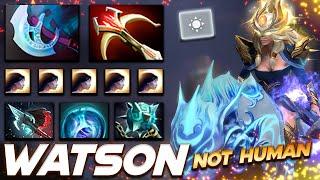 Watson Mirana Not Human - Dota 2 Pro Gameplay [Watch & Learn]