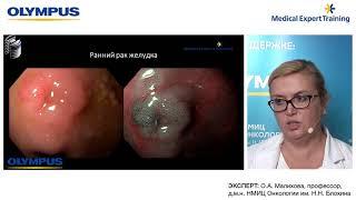 ЭКСПЕРТНЫЙ ВЕБИНАР "ТРУДНОСТИ В ДИФФЕРЕНЦИАЛЬНОЙ ДИАГНОСТИКЕ ОПУХОЛЕЙ ПИЩЕВОДА И ЖЕЛУДКА"