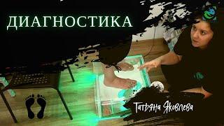 ДИАГНОСТИКА. Стопа на плантоскопе. Халюс вальгус.  Татьяна Яковлева