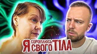 Я СОРОМЛЮСЬ СВОГО ТІЛА ► Щетина на обличчі жінки: як це змінити?