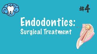 Endodontics | Surgical Treatment | INBDE, ADAT