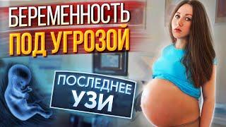 Беременность под Угрозой - Последнее УЗИ  - Я Беременна 37 Недель | Elli Di