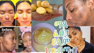 ድንሽ ክሬም /potato face cream /ማዳ ፈፀጋ ፀሊም ነጠብጣብ  ሙልጭ ኣብ ሓፂር ግዜ ከይሓልፈክን #ethiopia #tigray #habeshabeuty