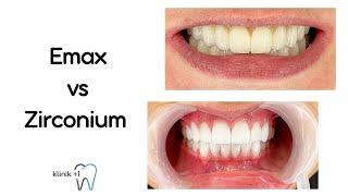 Emax vs. Zirconium Dental Crowns: A Comparative Analysis-Klinik+1 İstanbul Dental Clinic