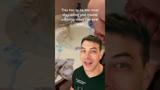 Derm Reacts to Insane Cyst Pop | 208SkinDoc Dr. Dustin Portela #shorts