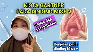 KISTA GARTNER - BENJOLAN DINDING MISS V - TUMOR JINAK MISS V