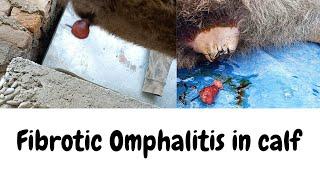 Fibrotic Omphalitis in a female Calf