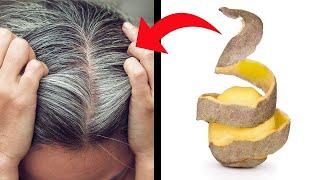 On day 17, the gray hair had completely disappeared! You'll be amazed by the results.