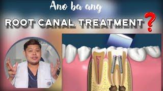 ANO BA ANG ROOT CANAL TREATMENT | Doc Noy