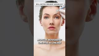 Does BOTOX REALLY Prevent WRINKLES ??