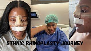 ETHNIC RHINOPLASTY WITH DR BORA.OK