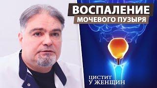 Цистит у женщин. Основные причины, симптомы, лечение, диагностика. Воспаление мочевого пузыря.