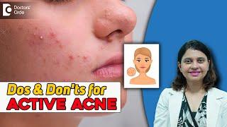 5 Things Not To Do on ACTIVE ACNE | Acne Prevention Tips at Home - Dr. Amee Daxini | Doctors' Circle