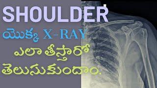 How to do xray shoulder Ap&Lat view& Anotomy of shoulder #trending #trendingvideo #shoulder