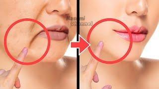 30 MINAnti-Aging Face Exercise to Reduce Marionette Lines, Lift Droopy Mouth Corners, Sagging Jowl
