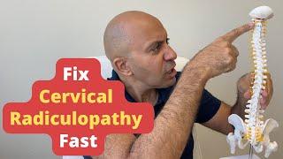 How to Fix Cervical Radiculopathy: 3 Powerful Treatments You Haven’t Heard Of