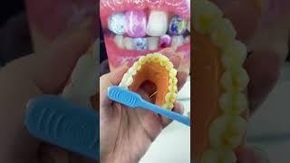 Boost Your Smile Game with These Must-Have Teeth Essentials! #fok #tooth