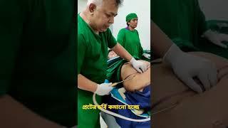 পেটের চর্বি কমানোর উপায় || Lower belly Fat Removing || Liposuction| ️01639139232 What’s App & imo